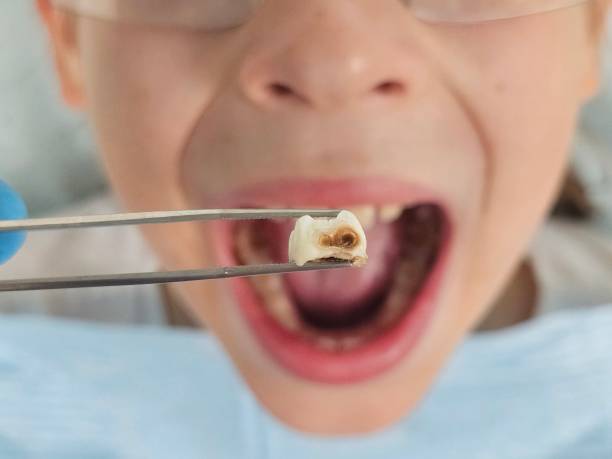 Best Pediatric Emergency Dentist in Boles Acres, NM